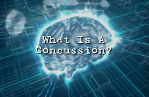 brain, concussion, TBI